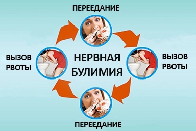 Лечение булимии в Средней Елюзани